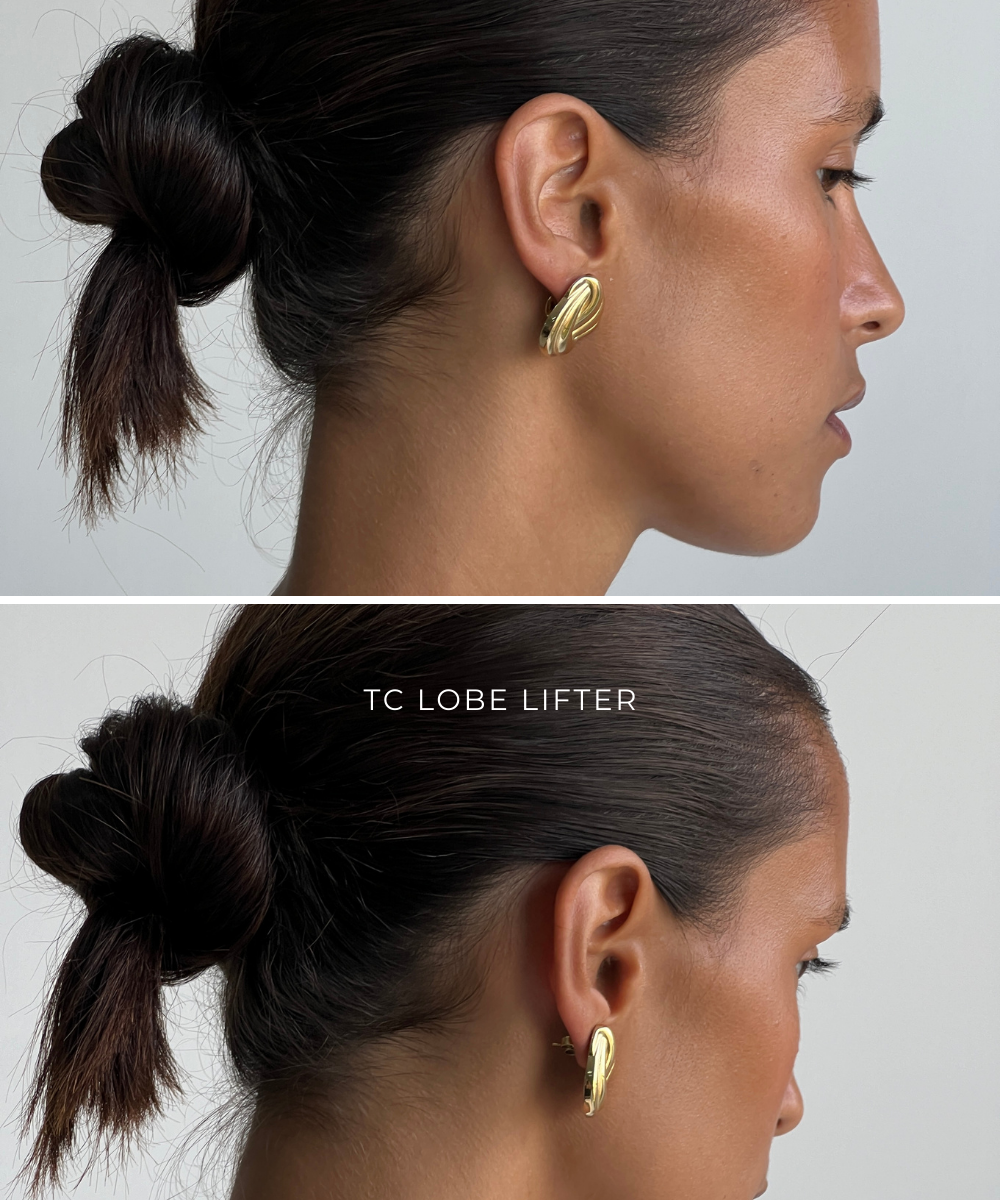 TC Lobe Lifters